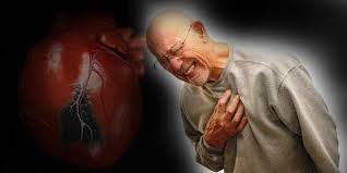 Cara Aman Menyembuhkan Inflamasi Jantung